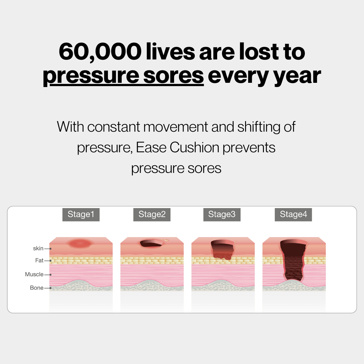Pressure Sores: Why Sitting Support Matters and How Ease Cushion® Helps Comfortably - easecushion