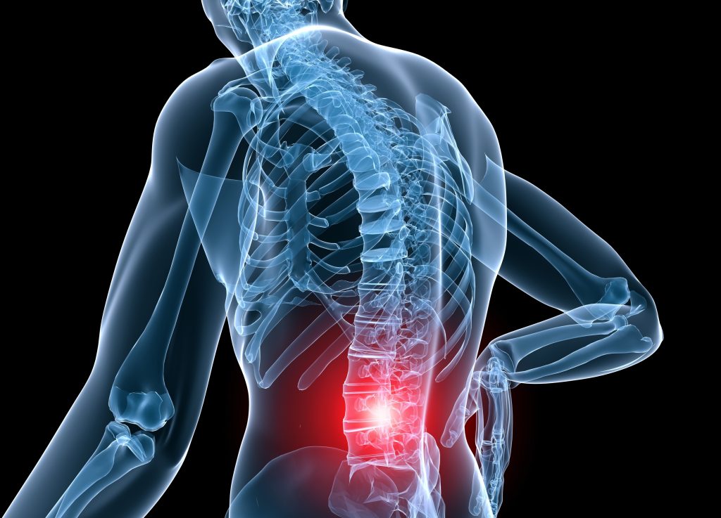 Comprehensive Guide to Lower Back Pain: Causes, Symptoms, Treatment, and Prevention